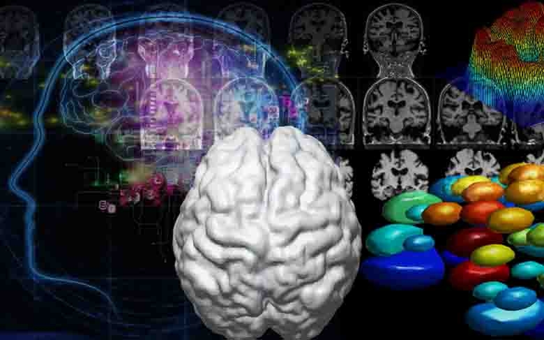 Inteligencia artificial para diagnosticar enfermedades neurodegenerativas
