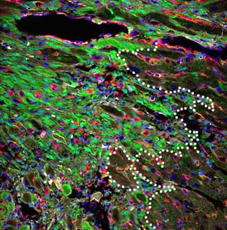 Investigadores obtienen resultados de gran impacto para el tratamiento de los infartos de miocardio