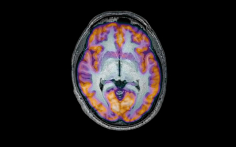 'Los secretos del cerebro' - Nuevo número de la revista Uciencia