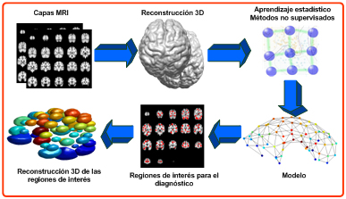 Inteligencia artificial para diagnosticar enfermedades neurodegenerativas