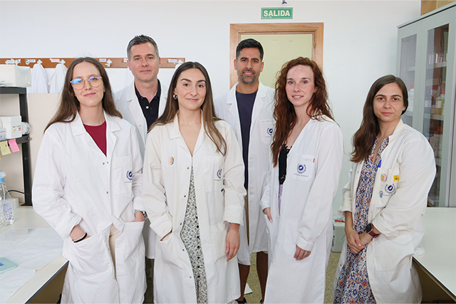 Hacia una mejor comprensión de los mecanismos responsables del avance del alzhéimer en el cerebro