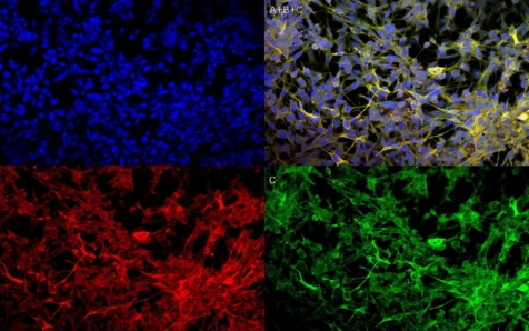 Demuestran el efecto neuroprotector del grafeno frente a los principales mecanismos celulares implicados en enfermedades como el párkinson